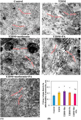 Apoptotic and proliferative processes in the small intestine of rats with type 2 diabetes mellitus after metformin and propionic acid treatment